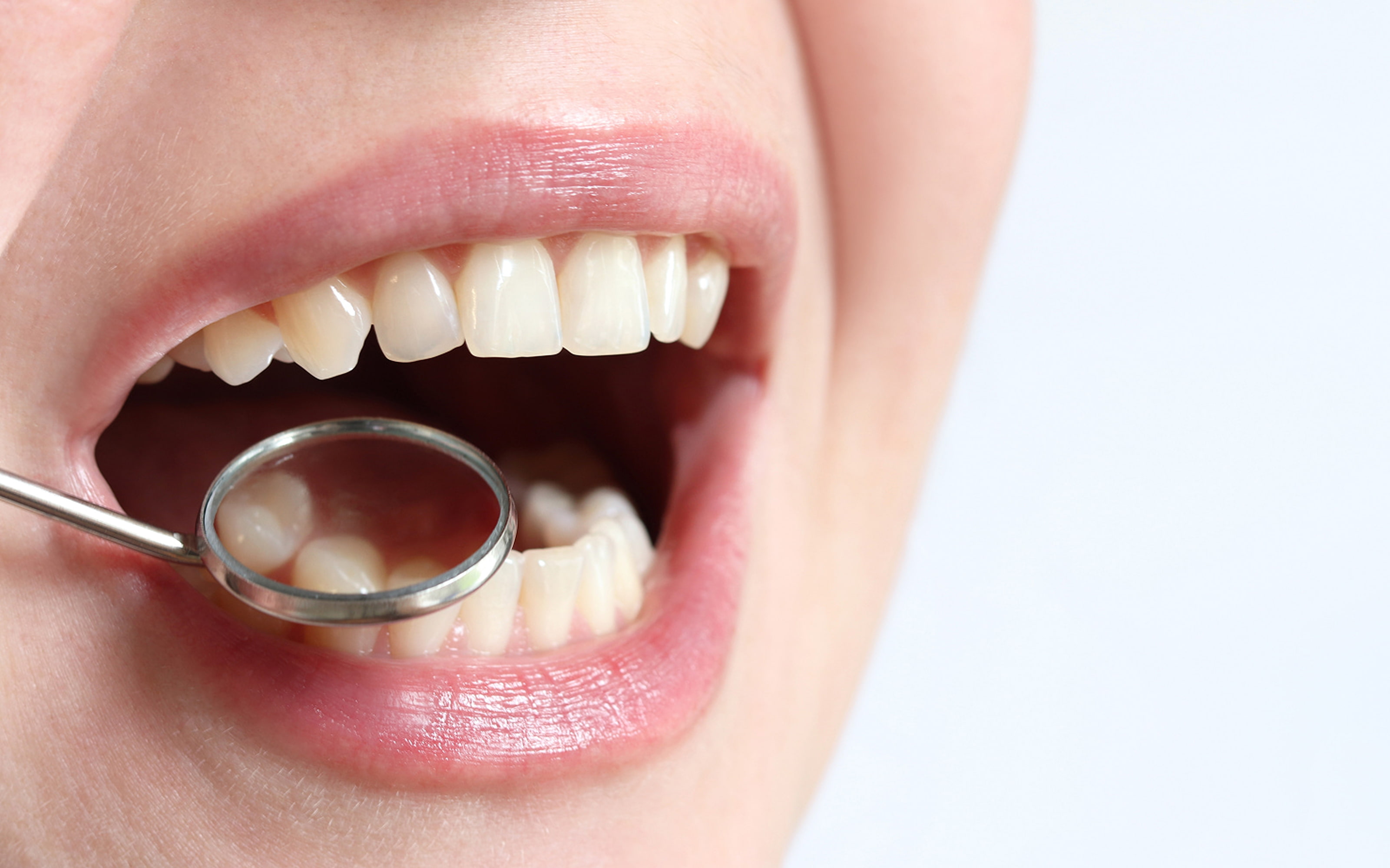 Why dental implant maintenance matters