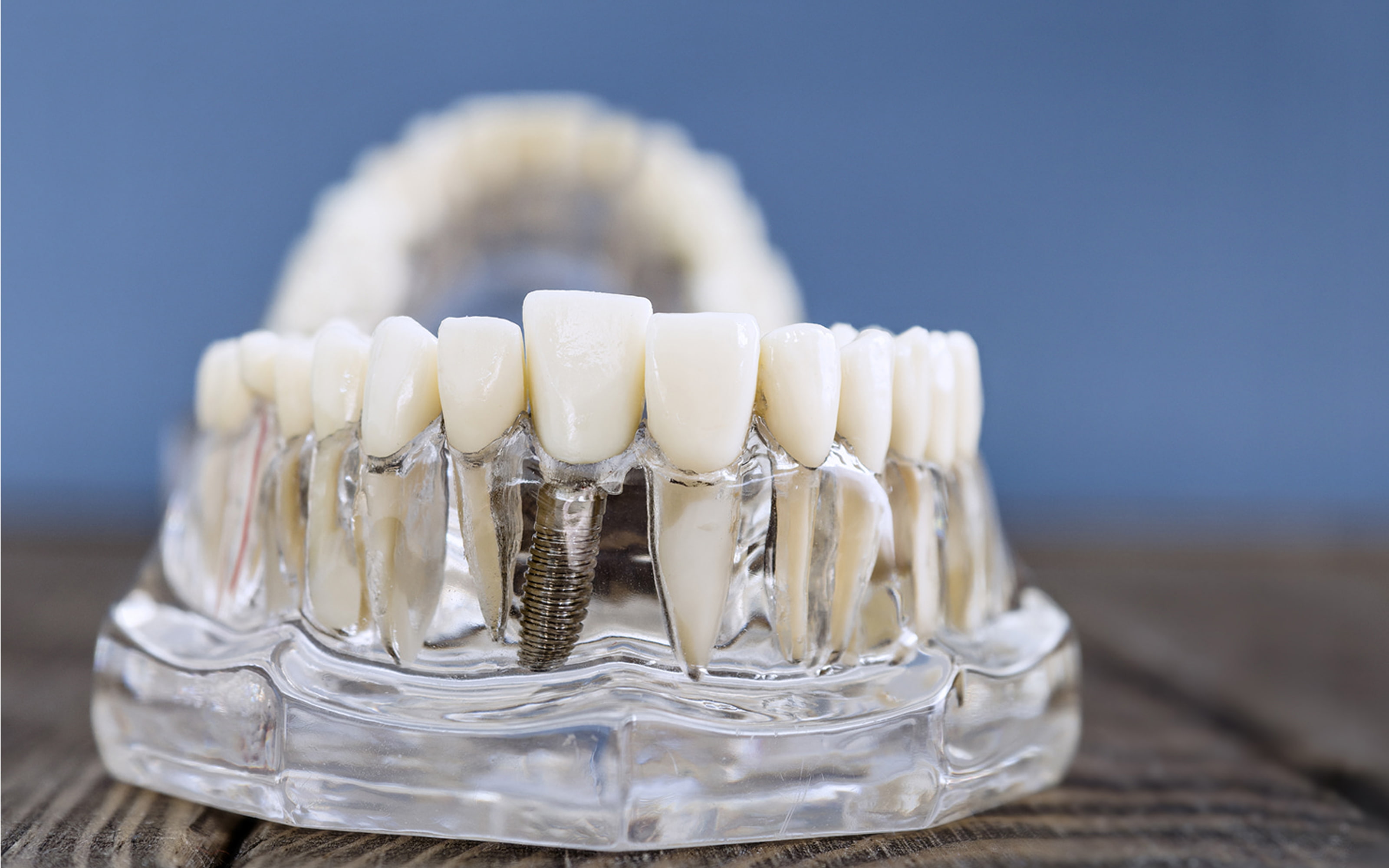 Daily care for dental implants