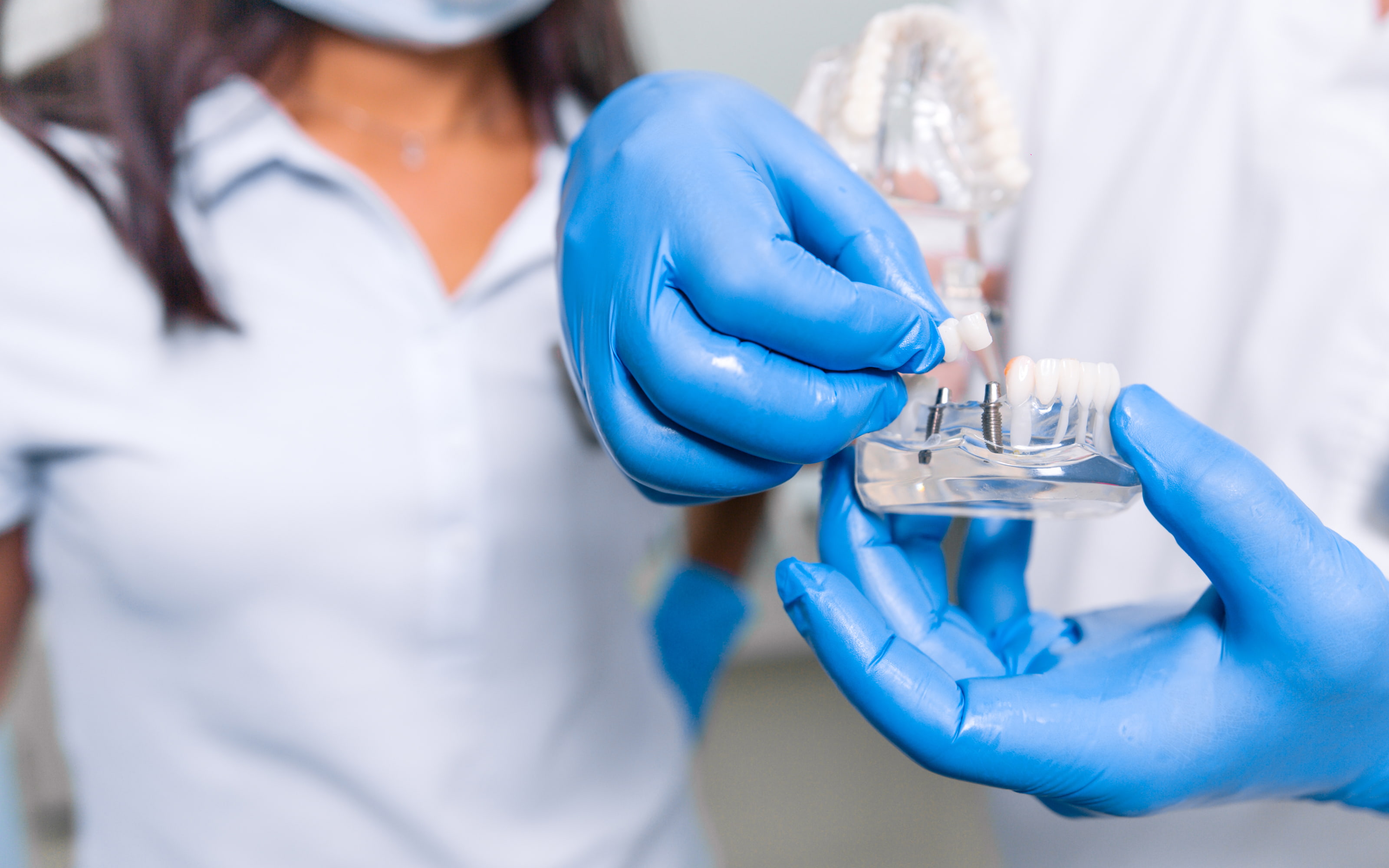 Benefits of dental implants