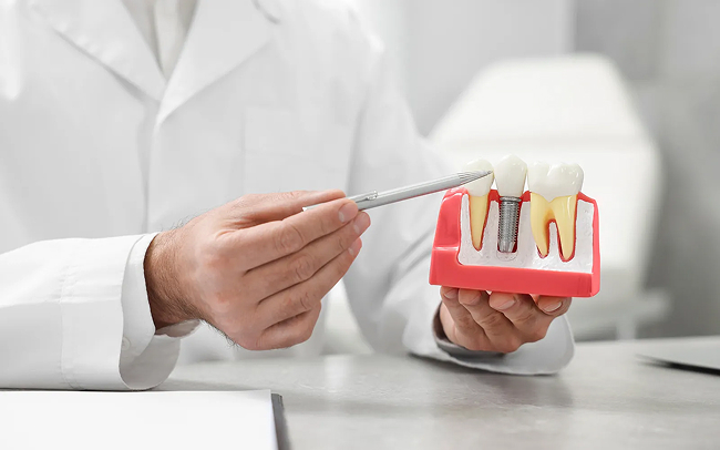 Built to Last — premium dental implants